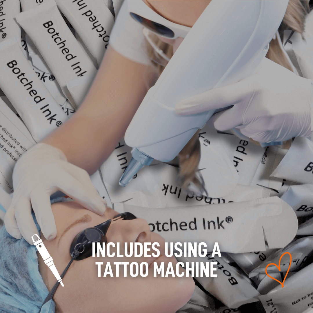 Non-laser tattoo removal training for laser techs, using tattoo machine method